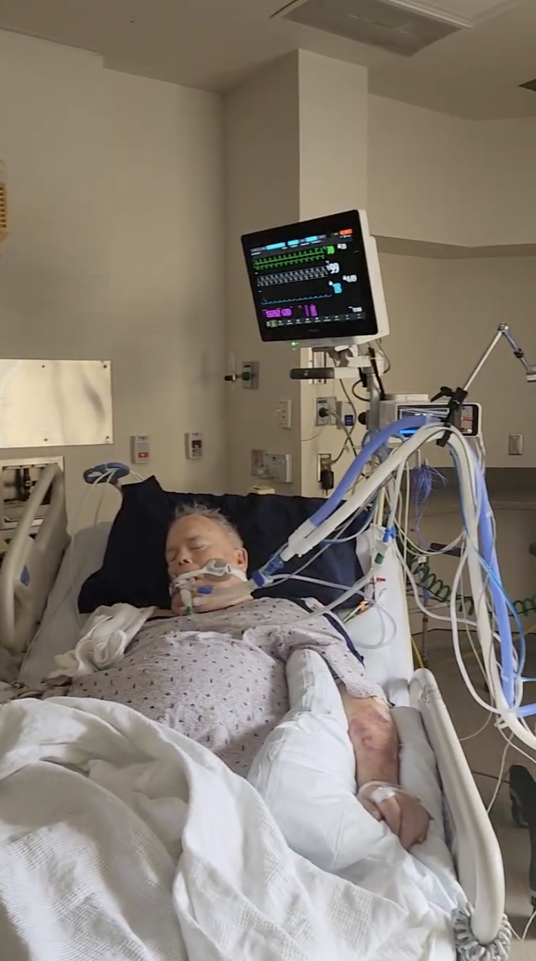 ALS patient in hospital bed on ventilator, surrounded by medical equipment during a caregiver crisis in June 2025